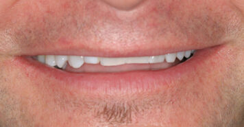 Family, Cosmetic & Implant Dentist in Lexington, KY