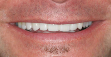 Family, Cosmetic & Implant Dentist in Lexington, KY