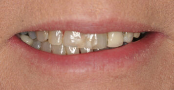 Family, Cosmetic & Implant Dentist in Lexington, KY