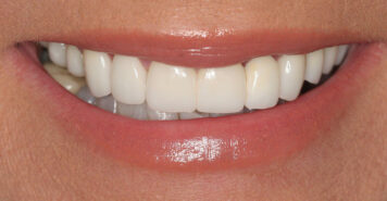 Family, Cosmetic & Implant Dentist in Lexington, KY