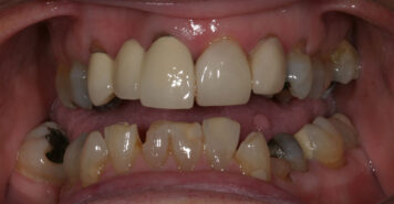 Family, Cosmetic & Implant Dentist in Lexington, KY