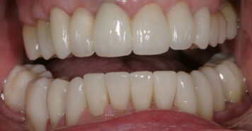 Family, Cosmetic & Implant Dentist in Lexington, KY