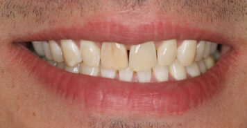 Family, Cosmetic & Implant Dentist in Lexington, KY