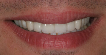 Family, Cosmetic & Implant Dentist in Lexington, KY