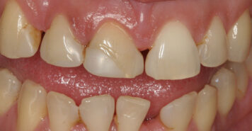 Family, Cosmetic & Implant Dentist in Lexington, KY