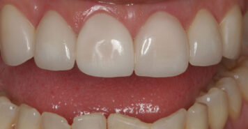 Family, Cosmetic & Implant Dentist in Lexington, KY