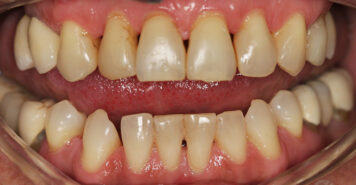 Family, Cosmetic & Implant Dentist in Lexington, KY