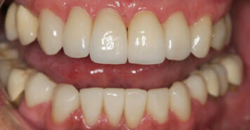 Family, Cosmetic & Implant Dentist in Lexington, KY