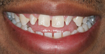 Family, Cosmetic & Implant Dentist in Lexington, KY
