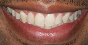 Family, Cosmetic & Implant Dentist in Lexington, KY