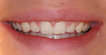 Family, Cosmetic & Implant Dentist in Lexington, KY