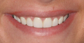 Family, Cosmetic & Implant Dentist in Lexington, KY