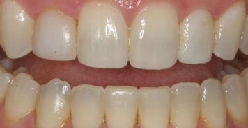 Family, Cosmetic & Implant Dentist in Lexington, KY