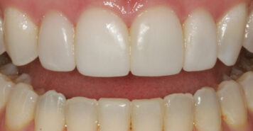 Family, Cosmetic & Implant Dentist in Lexington, KY