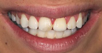 Family, Cosmetic & Implant Dentist in Lexington, KY