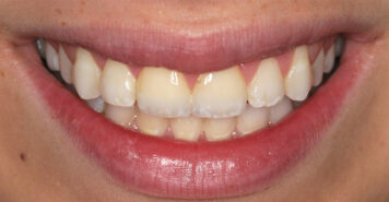 Family, Cosmetic & Implant Dentist in Lexington, KY