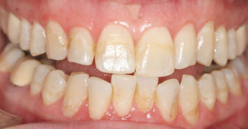 Family, Cosmetic & Implant Dentist in Lexington, KY