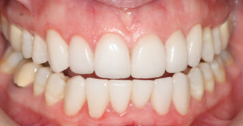 Family, Cosmetic & Implant Dentist in Lexington, KY