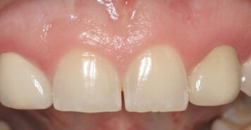 Family, Cosmetic & Implant Dentist in Lexington, KY