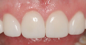 Family, Cosmetic & Implant Dentist in Lexington, KY
