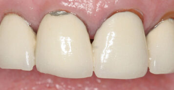 Family, Cosmetic & Implant Dentist in Lexington, KY
