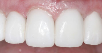 Family, Cosmetic & Implant Dentist in Lexington, KY