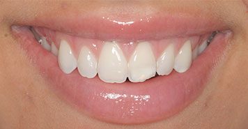 Family, Cosmetic & Implant Dentist in Lexington, KY