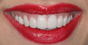 Family, Cosmetic & Implant Dentist in Lexington, KY