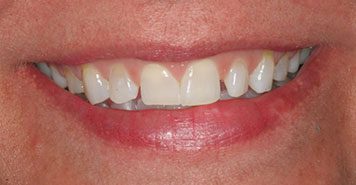 Family, Cosmetic & Implant Dentist in Lexington, KY