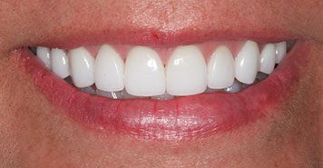 Family, Cosmetic & Implant Dentist in Lexington, KY