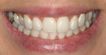 Family, Cosmetic & Implant Dentist in Lexington, KY
