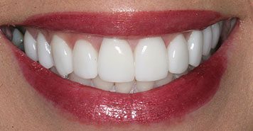 Family, Cosmetic & Implant Dentist in Lexington, KY