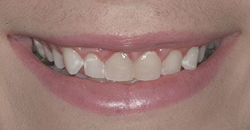 Family, Cosmetic & Implant Dentist in Lexington, KY