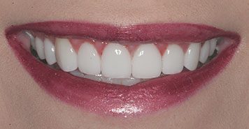 Family, Cosmetic & Implant Dentist in Lexington, KY