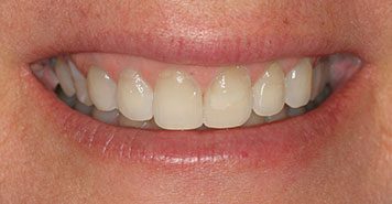 Family, Cosmetic & Implant Dentist in Lexington, KY