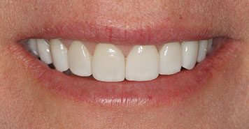 Family, Cosmetic & Implant Dentist in Lexington, KY