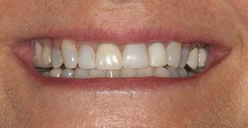 Family, Cosmetic & Implant Dentist in Lexington, KY