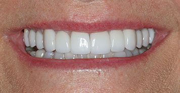 Family, Cosmetic & Implant Dentist in Lexington, KY