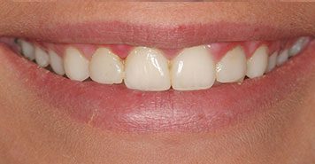 Family, Cosmetic & Implant Dentist in Lexington, KY