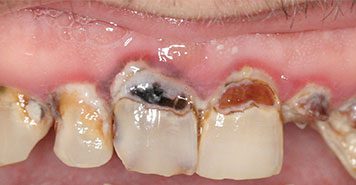 Family, Cosmetic & Implant Dentist in Lexington, KY