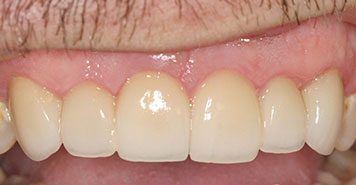 Family, Cosmetic & Implant Dentist in Lexington, KY