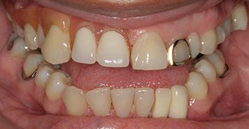 Family, Cosmetic & Implant Dentist in Lexington, KY