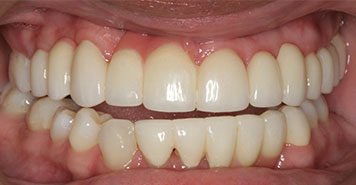 Family, Cosmetic & Implant Dentist in Lexington, KY