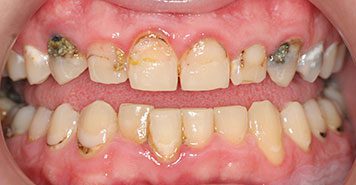 Family, Cosmetic & Implant Dentist in Lexington, KY
