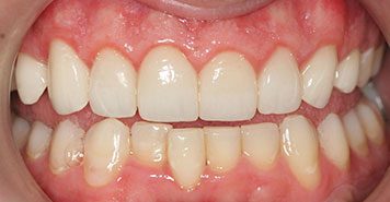 Family, Cosmetic & Implant Dentist in Lexington, KY