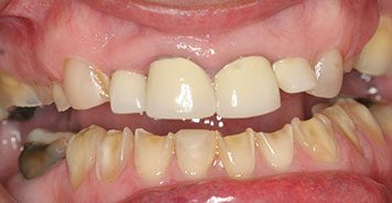 Family, Cosmetic & Implant Dentist in Lexington, KY