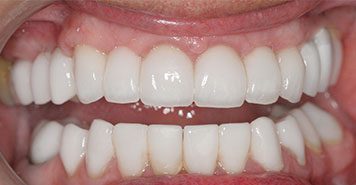 Family, Cosmetic & Implant Dentist in Lexington, KY