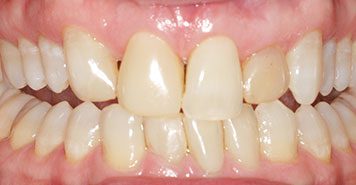 Family, Cosmetic & Implant Dentist in Lexington, KY