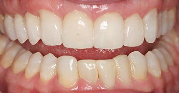 Family, Cosmetic & Implant Dentist in Lexington, KY