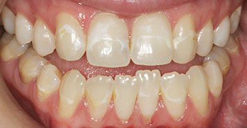 Family, Cosmetic & Implant Dentist in Lexington, KY